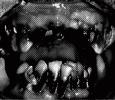 The Homicides – “Loosing Teeth EP”